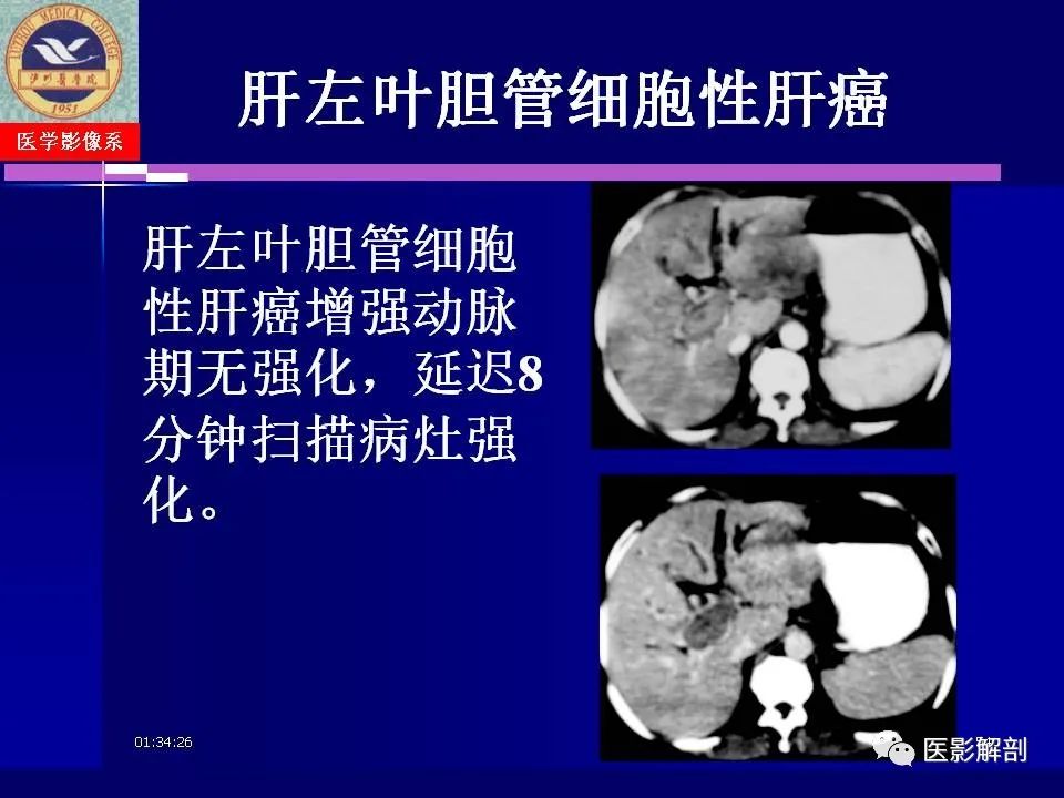 影像PPT - 【PPT】胆道系统病变的CT诊断-54