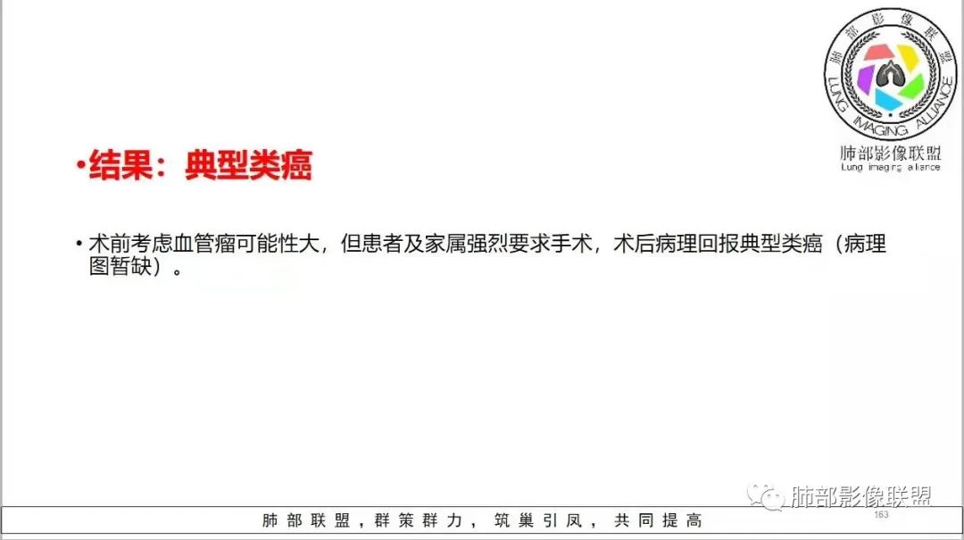 影像PPT - 【病例】右肺门区高强化肿块—类癌1例CT影像-101 影像PPT - 【病例】右肺门区高强化肿块—类癌1例CT影像-101