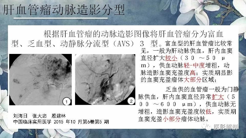 影像PPT - 【PPT】肝血管瘤的分型与影像学诊断-24