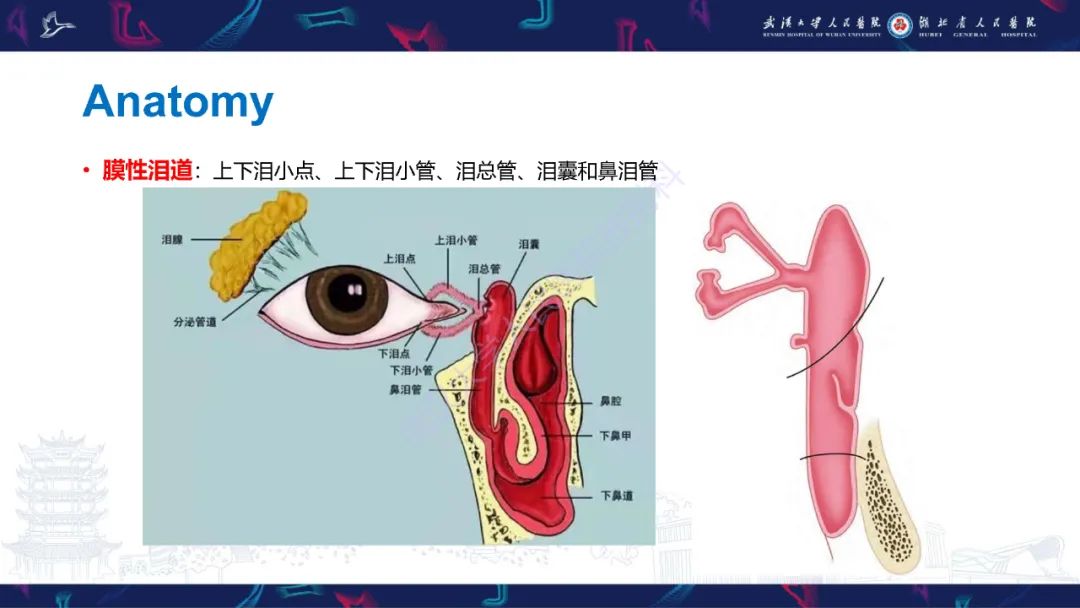 影像PPT - 【PPT】泪道病变影像诊断-6