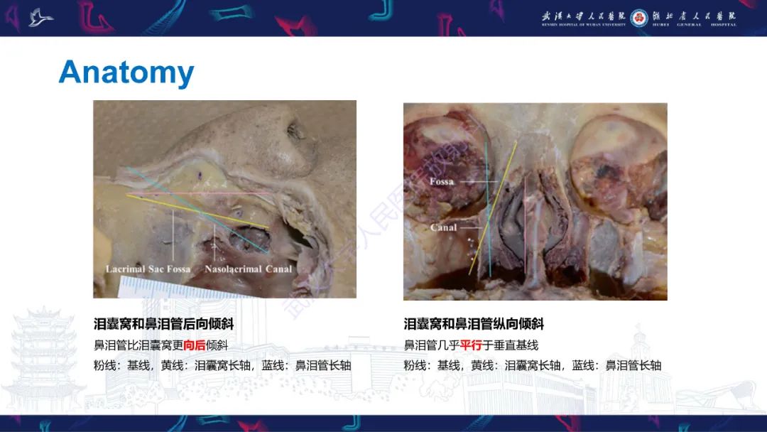 影像PPT - 【PPT】泪道病变影像诊断-10