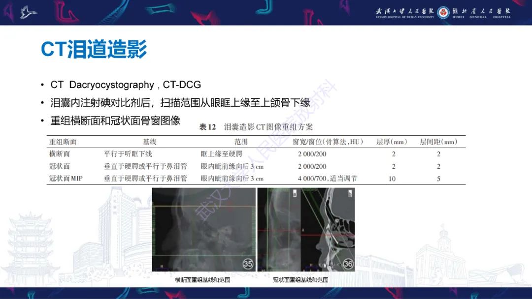 影像PPT - 【PPT】泪道病变影像诊断-12