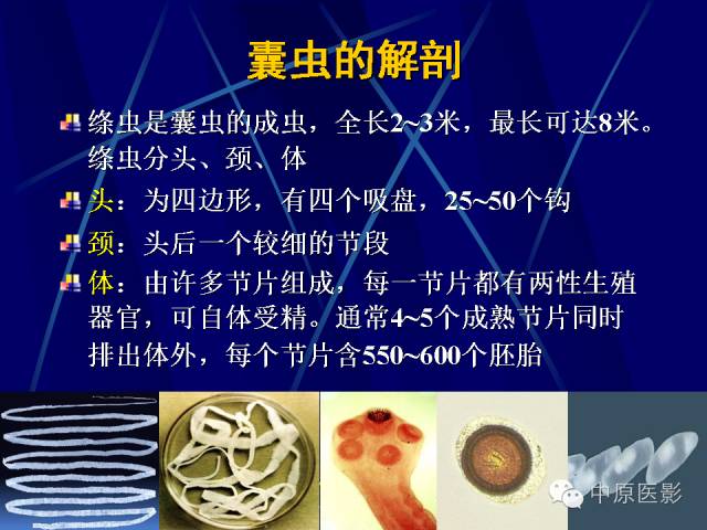 影像PPT - 【PPT】脑囊虫病的影像学诊断-3