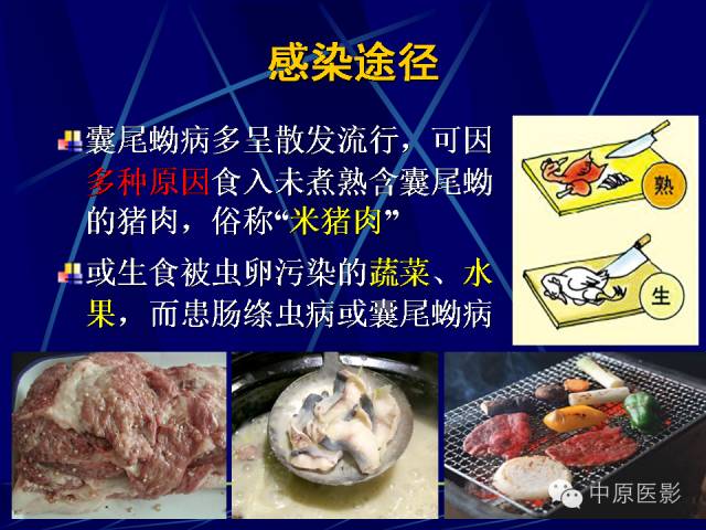 影像PPT - 【PPT】脑囊虫病的影像学诊断-7