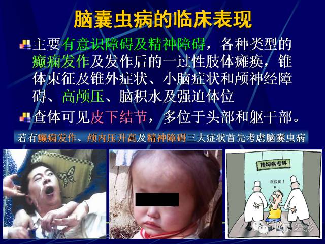 影像PPT - 【PPT】脑囊虫病的影像学诊断-10
