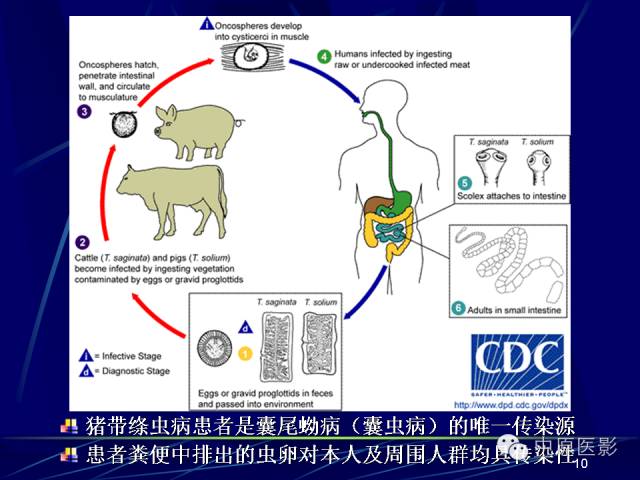 影像PPT - 【PPT】脑囊虫病的影像学诊断-9