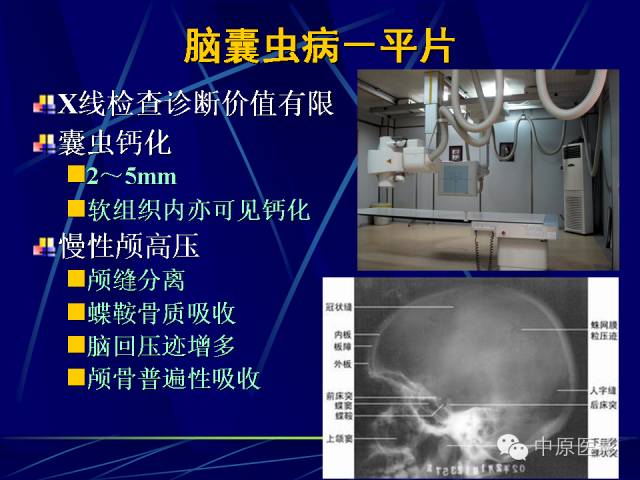 影像PPT - 【PPT】脑囊虫病的影像学诊断-16