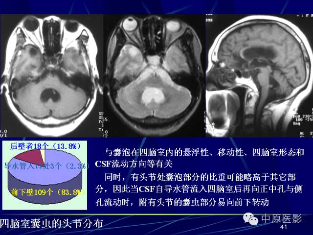 影像PPT - 【PPT】脑囊虫病的影像学诊断-40