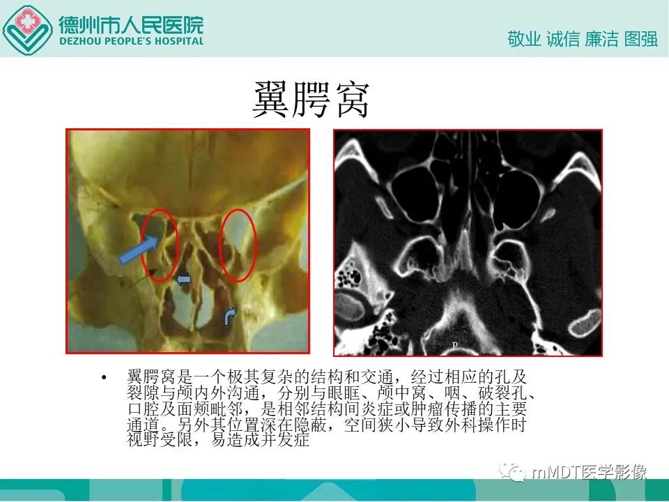 影像PPT - 【PPT】小小孔穴连洞天——翼腭窝的颅底交通-2