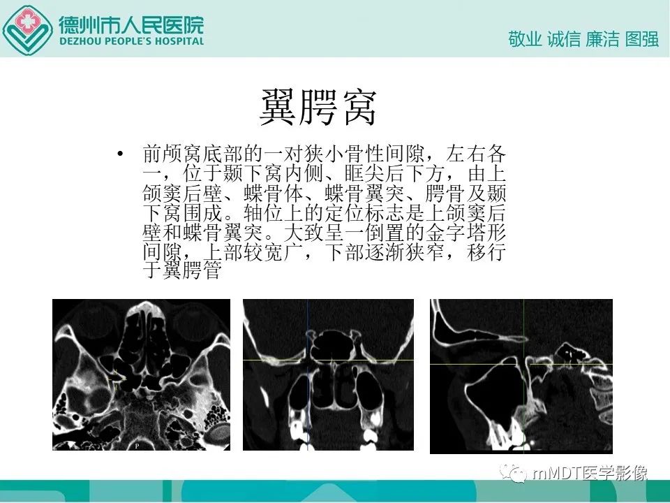 影像PPT - 【PPT】小小孔穴连洞天——翼腭窝的颅底交通-3