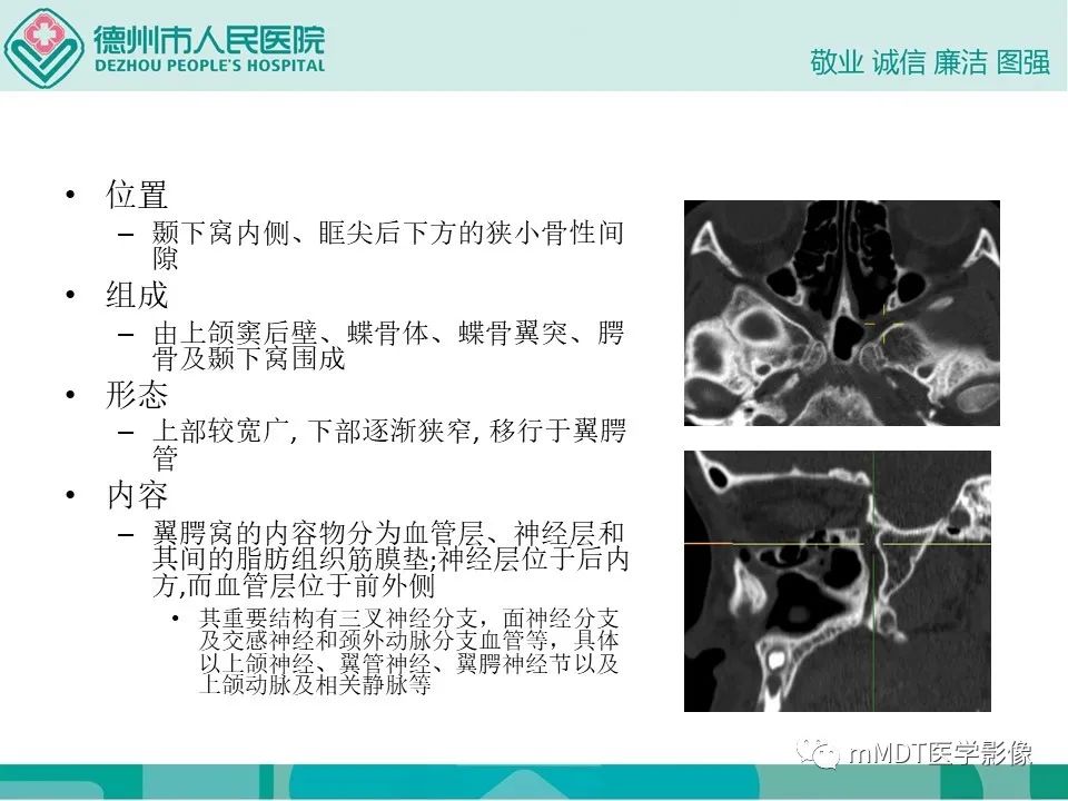 影像PPT - 【PPT】小小孔穴连洞天——翼腭窝的颅底交通-4
