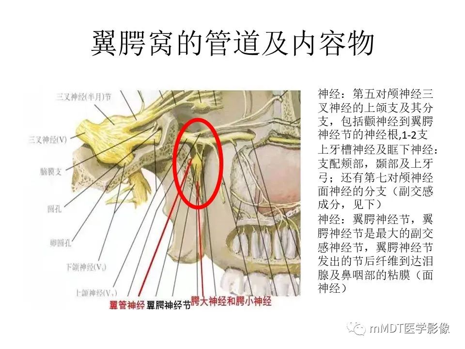 影像PPT - 【PPT】小小孔穴连洞天——翼腭窝的颅底交通-9