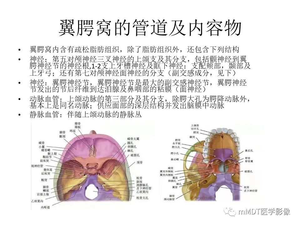 影像PPT - 【PPT】小小孔穴连洞天——翼腭窝的颅底交通-8