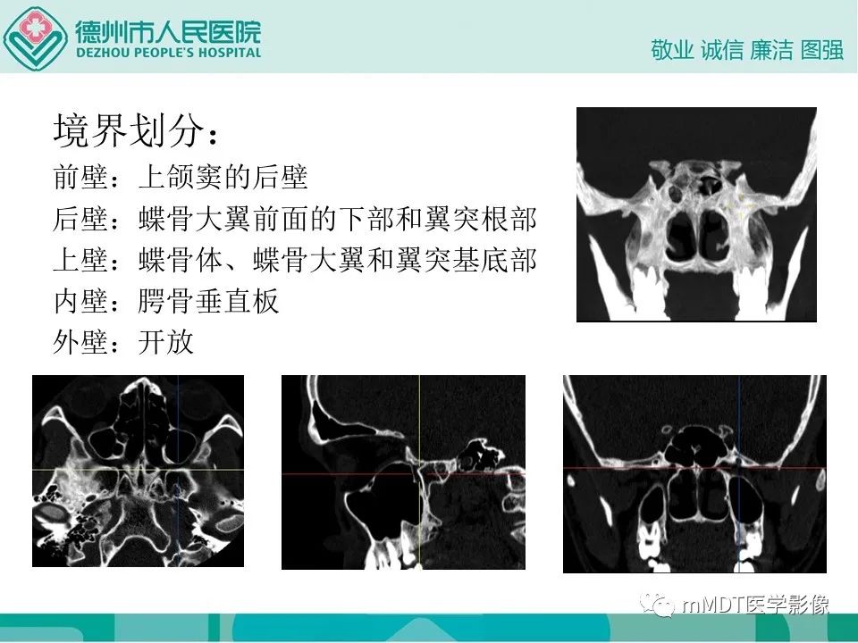 影像PPT - 【PPT】小小孔穴连洞天——翼腭窝的颅底交通-5