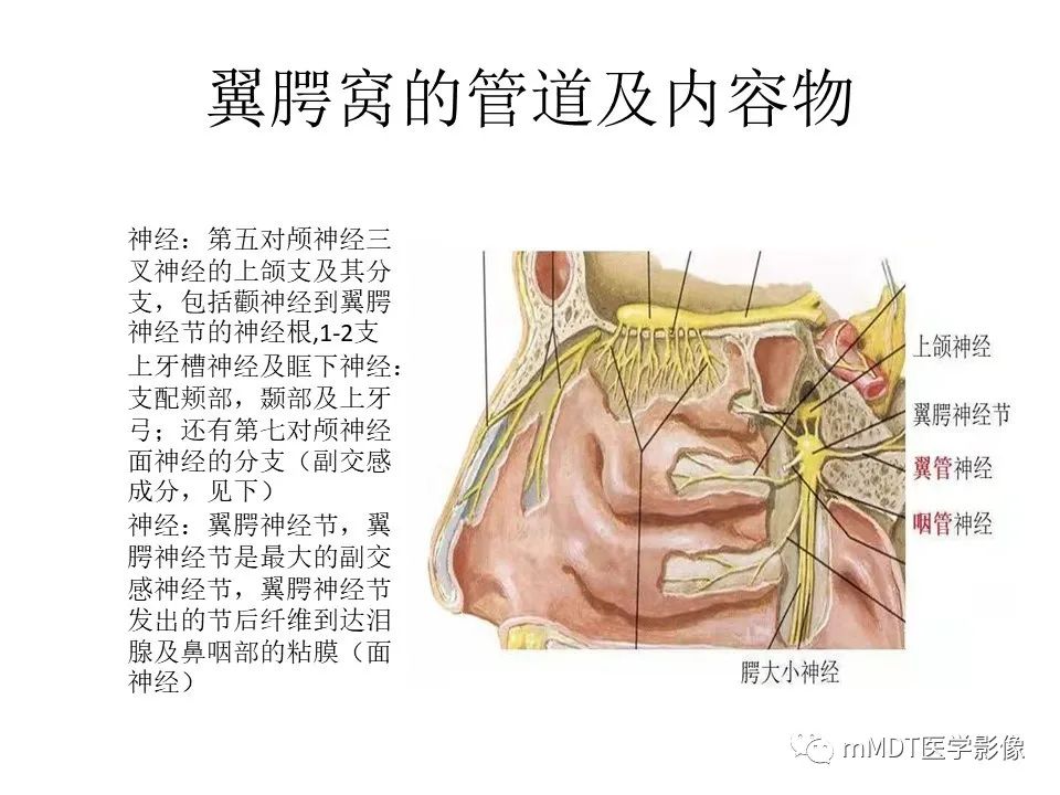影像PPT - 【PPT】小小孔穴连洞天——翼腭窝的颅底交通-10