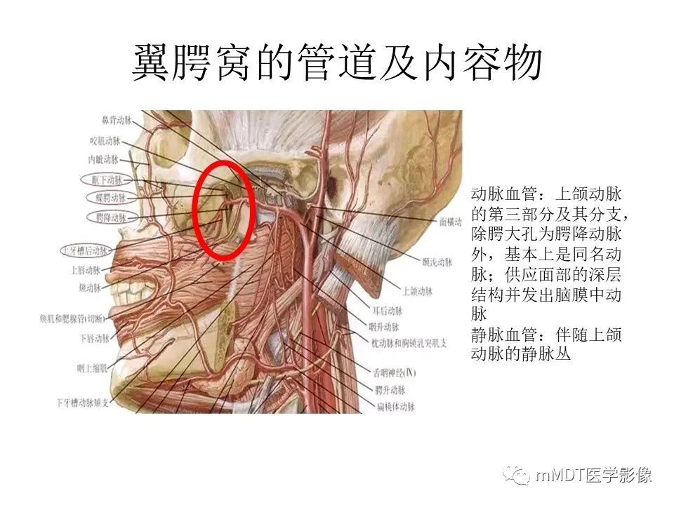 影像PPT - 【PPT】小小孔穴连洞天——翼腭窝的颅底交通-11