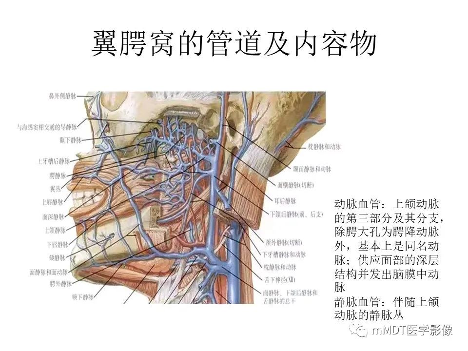 影像PPT - 【PPT】小小孔穴连洞天——翼腭窝的颅底交通-13