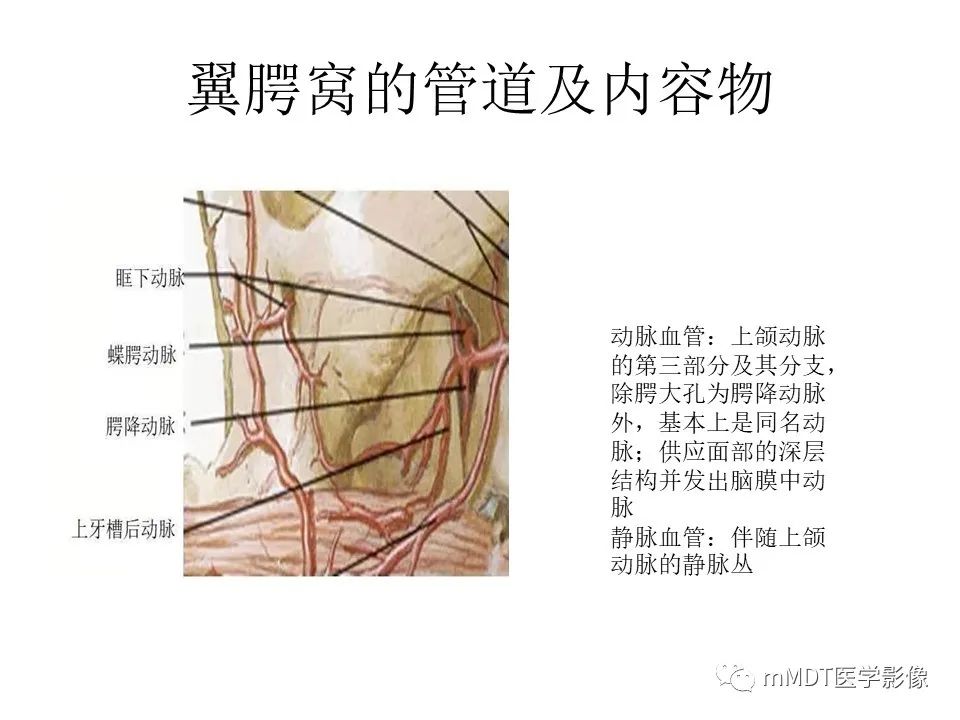 影像PPT - 【PPT】小小孔穴连洞天——翼腭窝的颅底交通-12