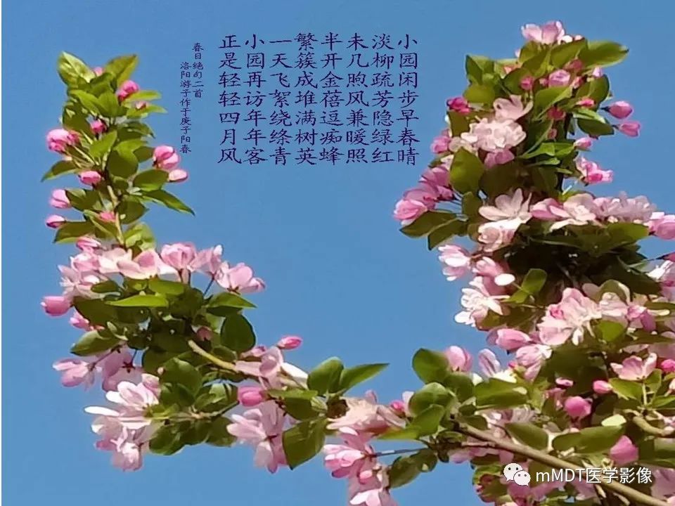 影像PPT - 【PPT】小小孔穴连洞天——翼腭窝的颅底交通-15