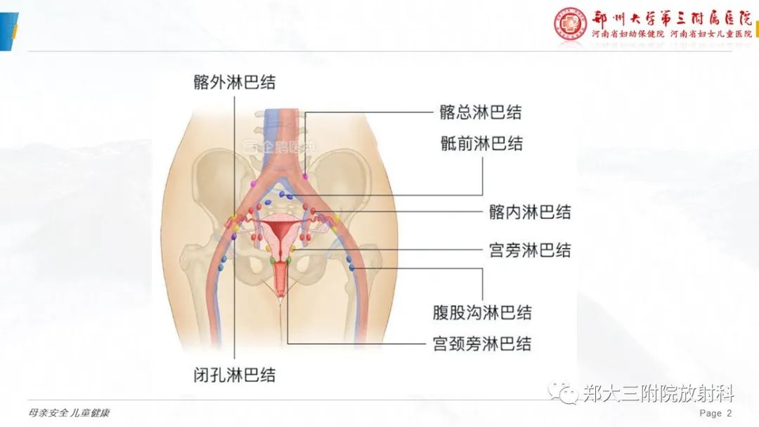影像PPT - 【PPT】妇科恶性肿瘤淋巴结转移特点-2