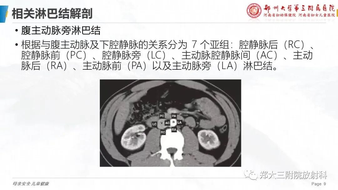 影像PPT - 【PPT】妇科恶性肿瘤淋巴结转移特点-8
