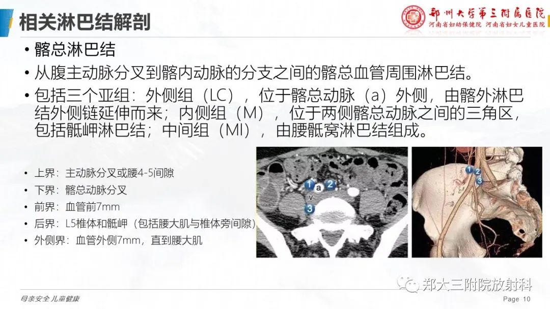 影像PPT - 【PPT】妇科恶性肿瘤淋巴结转移特点-9