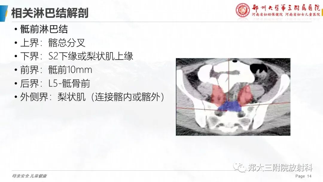 影像PPT - 【PPT】妇科恶性肿瘤淋巴结转移特点-12