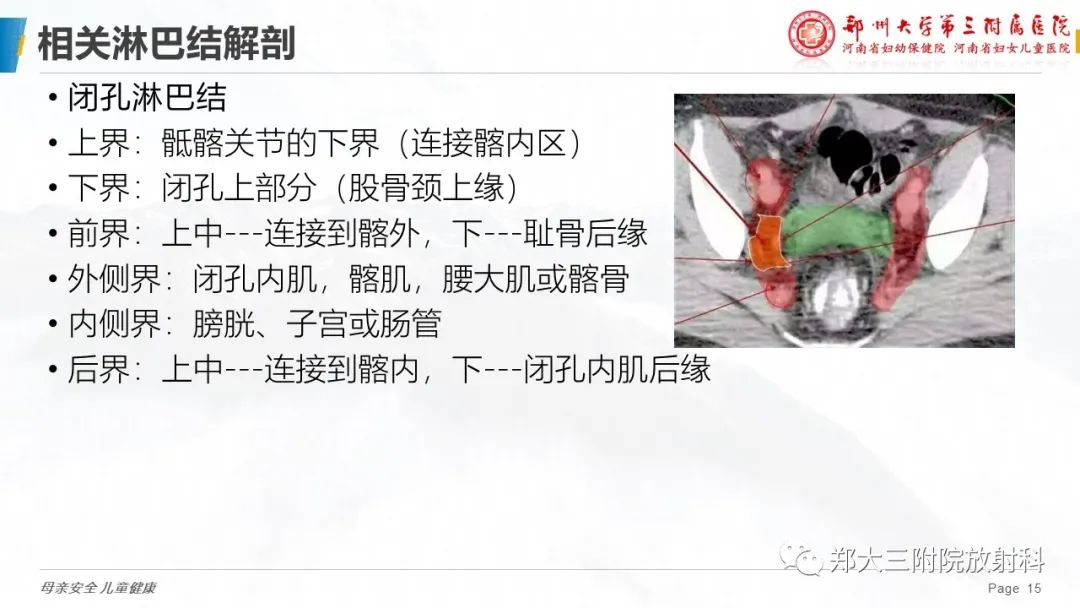 影像PPT - 【PPT】妇科恶性肿瘤淋巴结转移特点-13