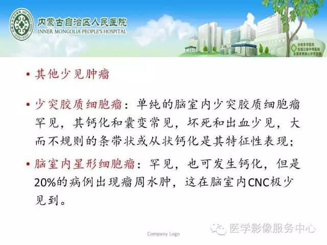 影像PPT - 【病例】侧脑室中枢神经细胞瘤伴血管瘤样改变1例MR-43 影像PPT - 【病例】侧脑室中枢神经细胞瘤伴血管瘤样改变1例MR-43