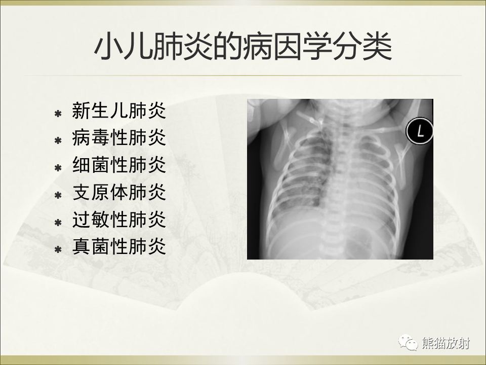 影像PPT - 【PPT】小儿肺炎的影像学诊断-30