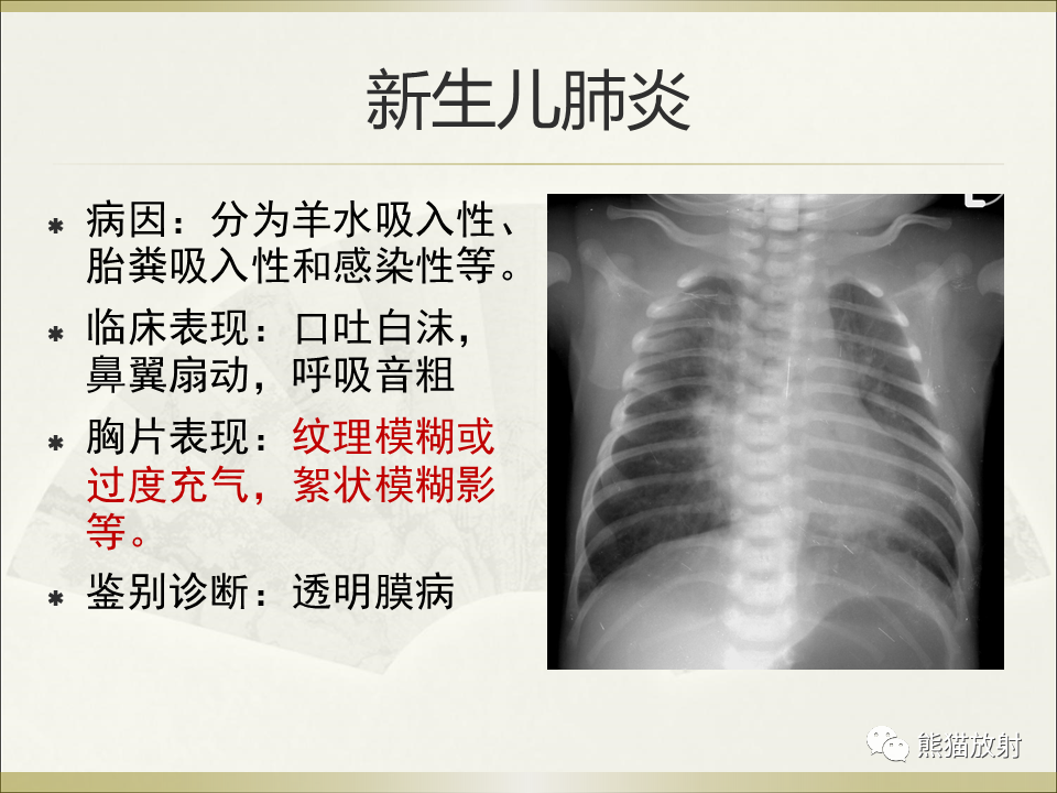 影像PPT - 【PPT】小儿肺炎的影像学诊断-31