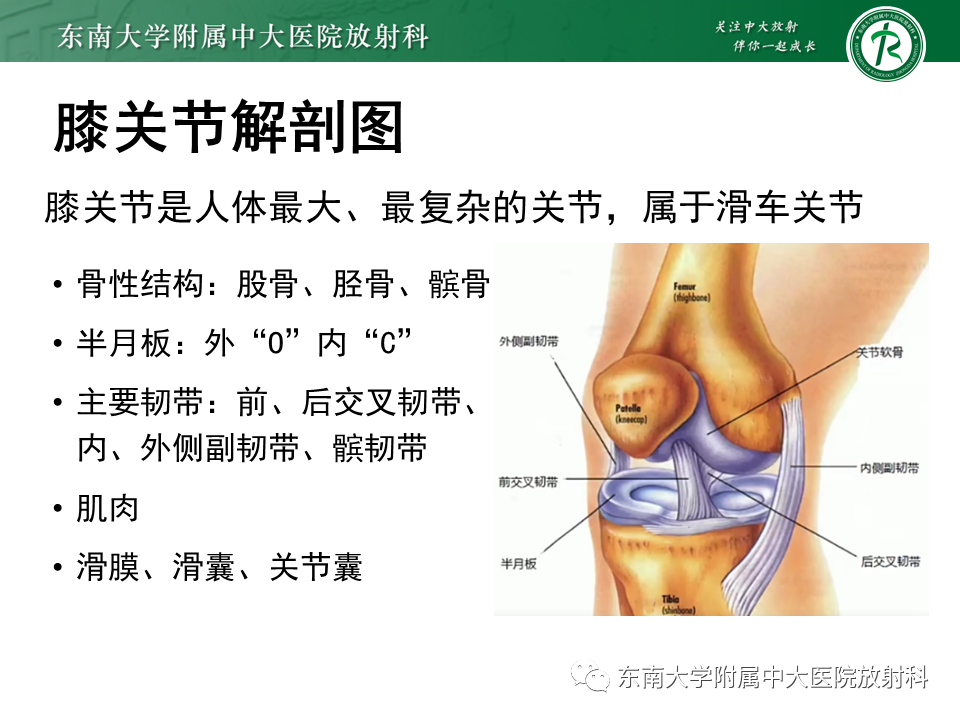 影像PPT - 【PPT】膝关节前交叉韧带损伤-3
