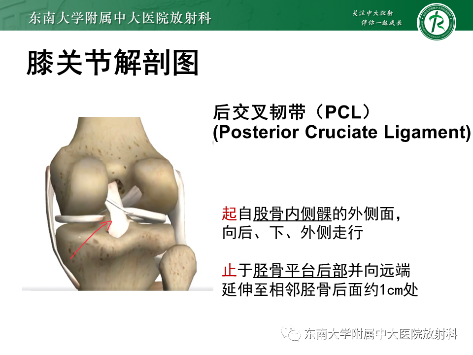 影像PPT - 【PPT】膝关节前交叉韧带损伤-6