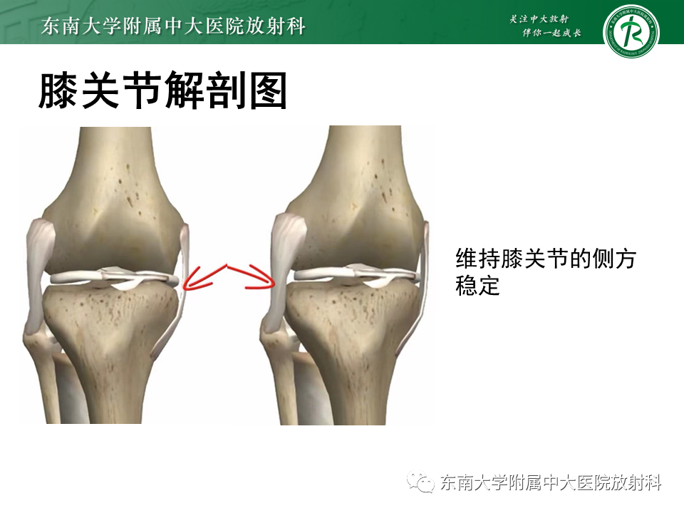 影像PPT - 【PPT】膝关节前交叉韧带损伤-4