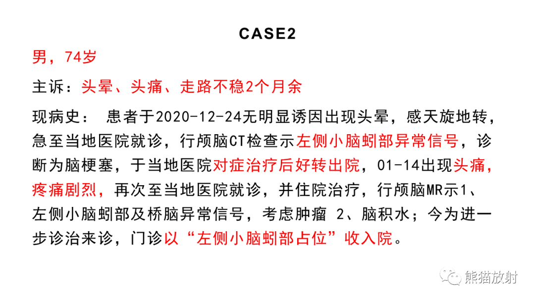 影像PPT - 【病例】原发性中枢神经系统淋巴瘤2例MR-15