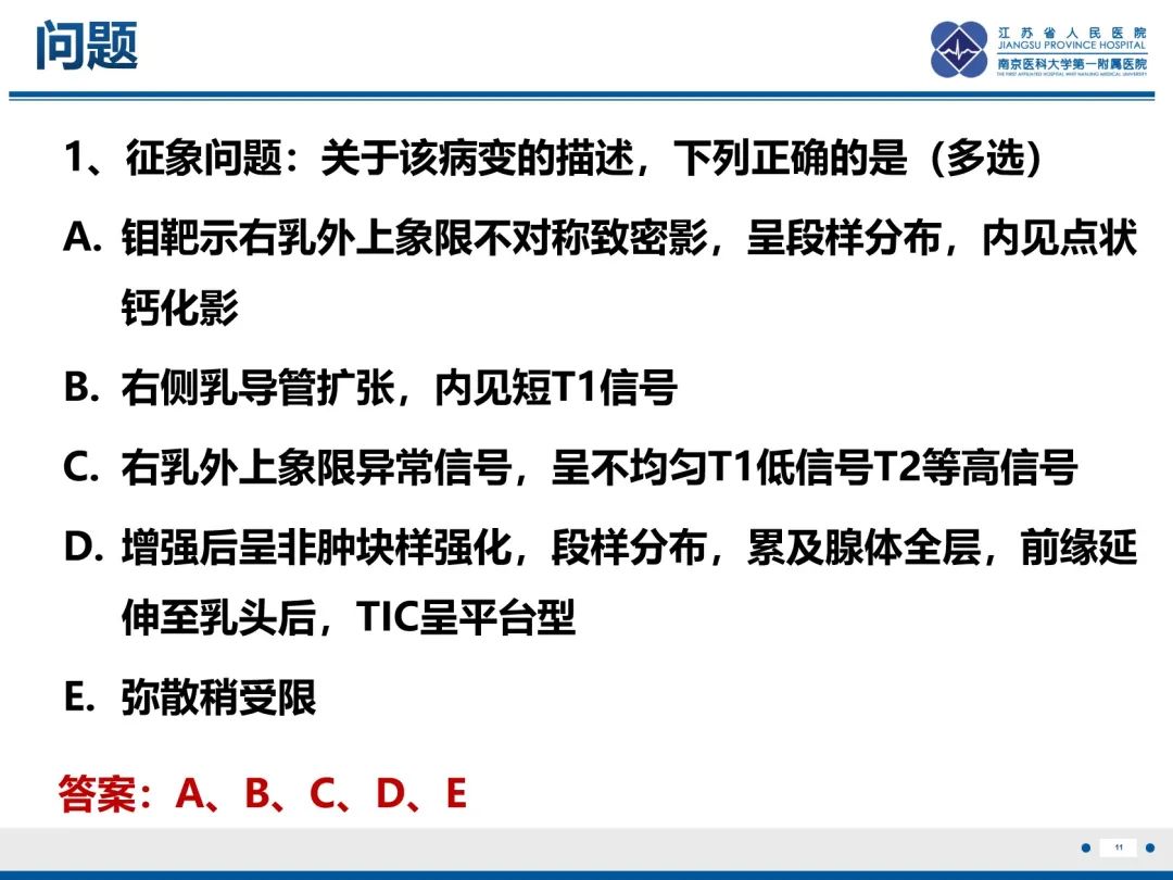 影像PPT - 【PPT】乳腺实性乳头状癌-12
