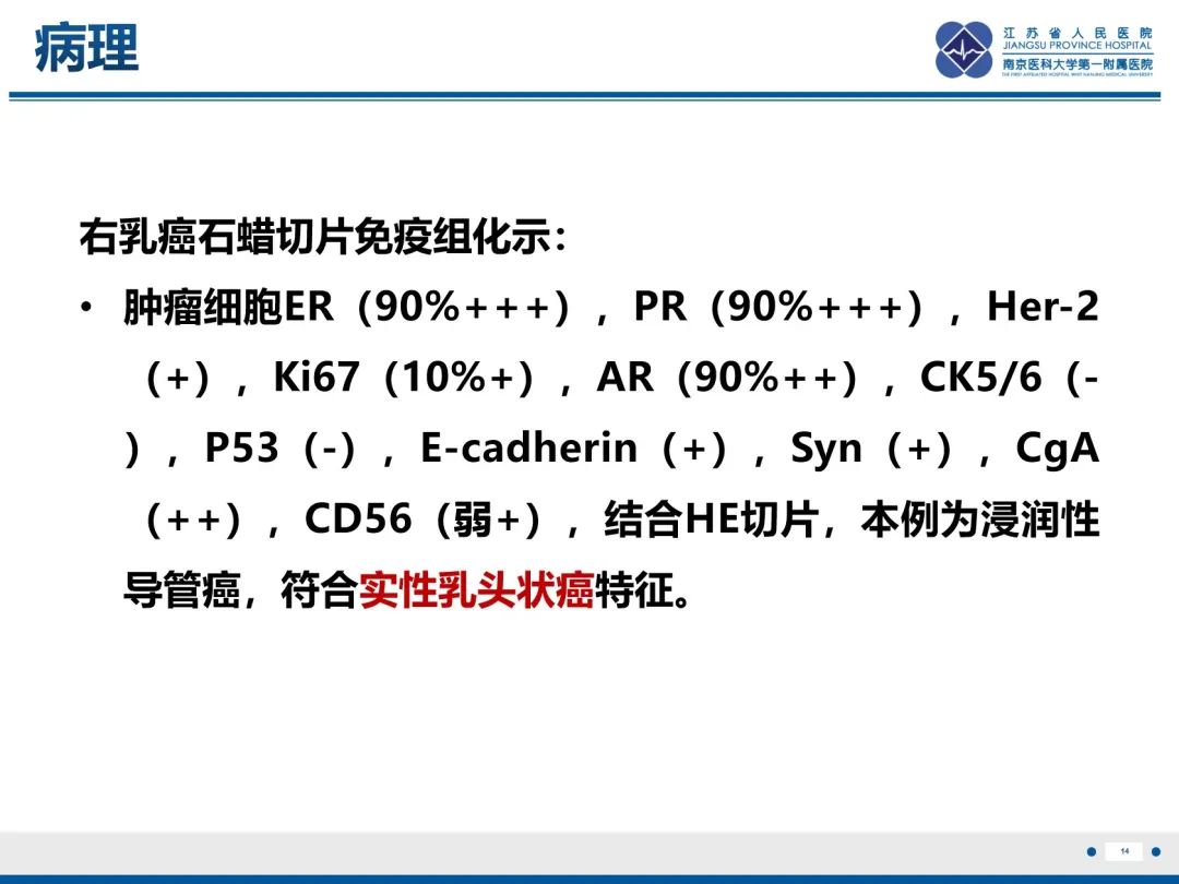 影像PPT - 【PPT】乳腺实性乳头状癌-15