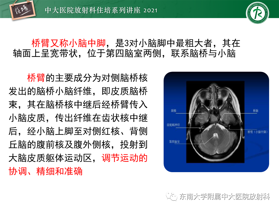 影像PPT - 【PPT】双侧桥臂磁共振异常信号的影像诊断思路-6