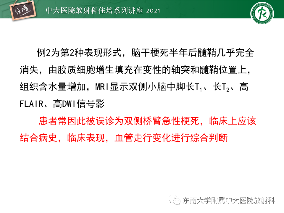 影像PPT - 【PPT】双侧桥臂磁共振异常信号的影像诊断思路-20