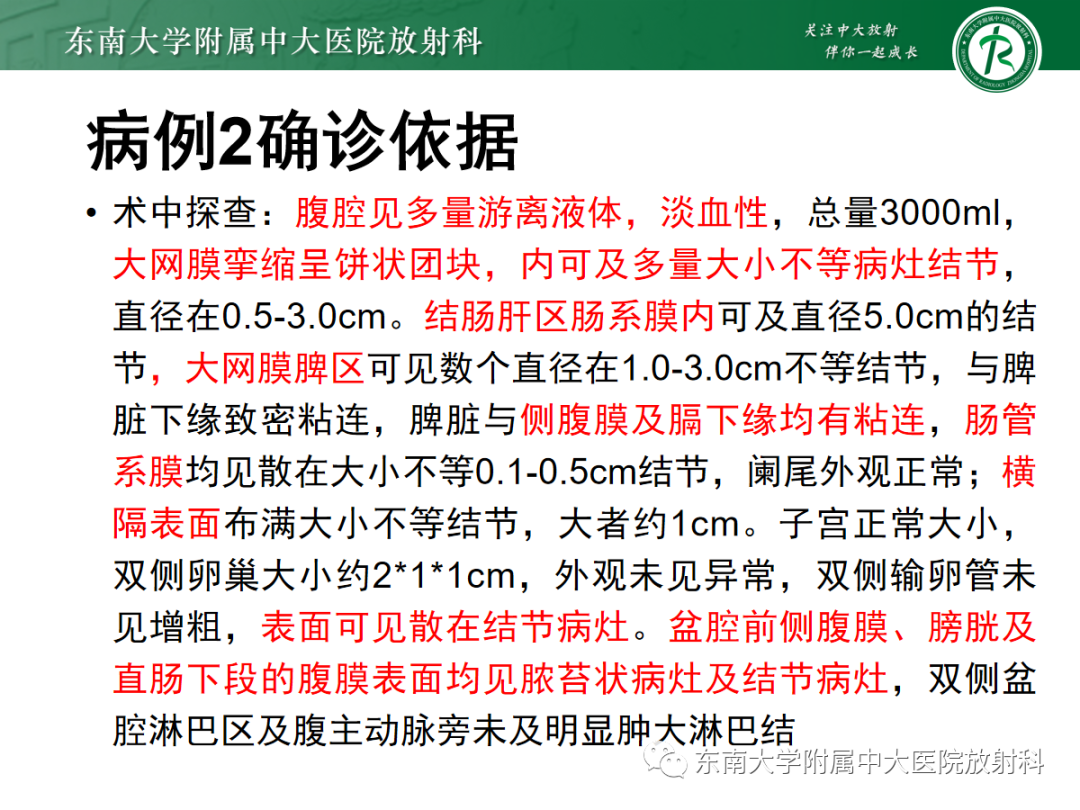 影像PPT - 【PPT】腹膜弥漫性病变-19 影像PPT - 【PPT】腹膜弥漫性病变-19