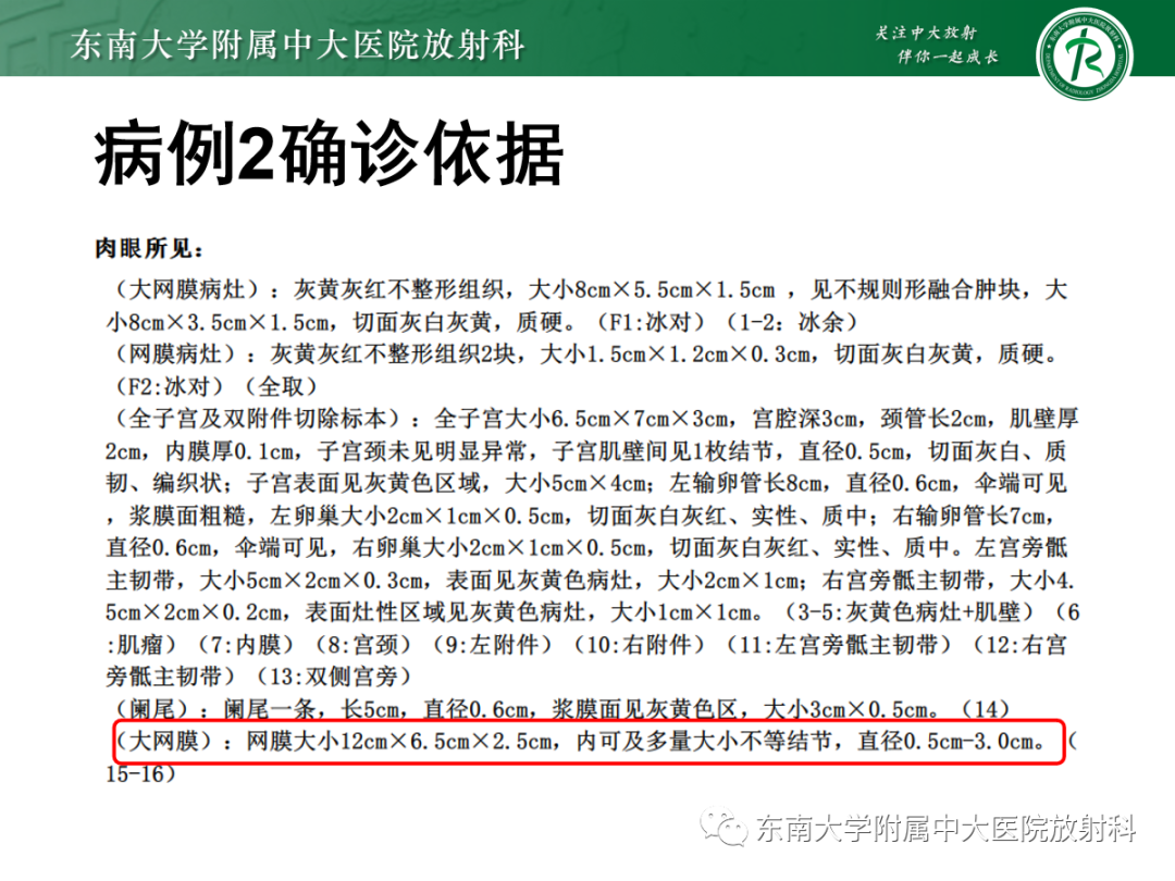 影像PPT - 【PPT】腹膜弥漫性病变-20 影像PPT - 【PPT】腹膜弥漫性病变-20