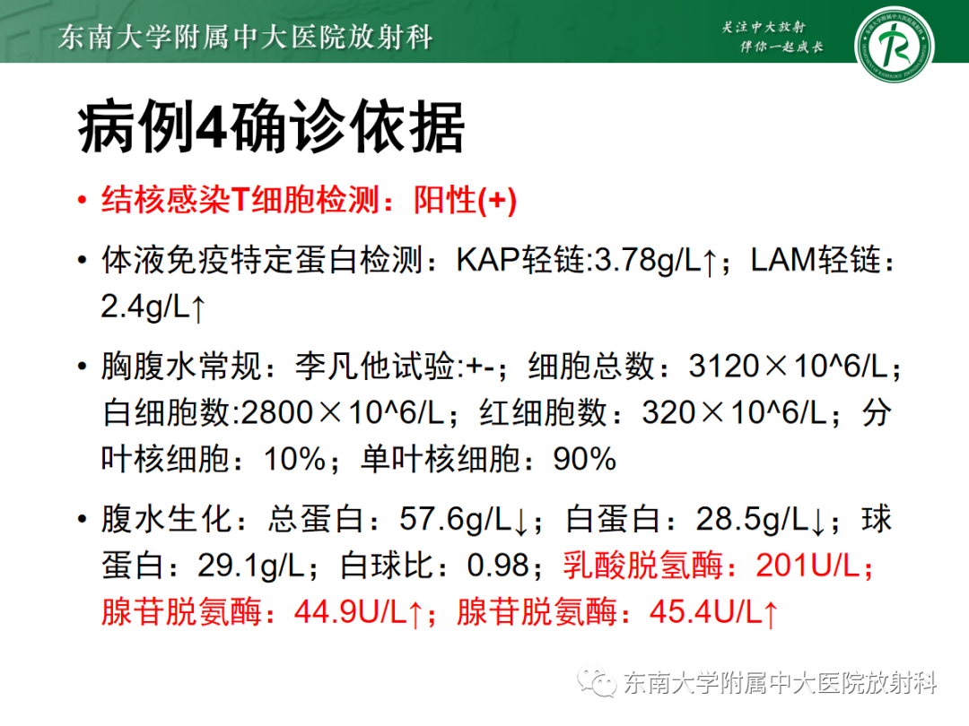 影像PPT - 【PPT】腹膜弥漫性病变-27 影像PPT - 【PPT】腹膜弥漫性病变-27