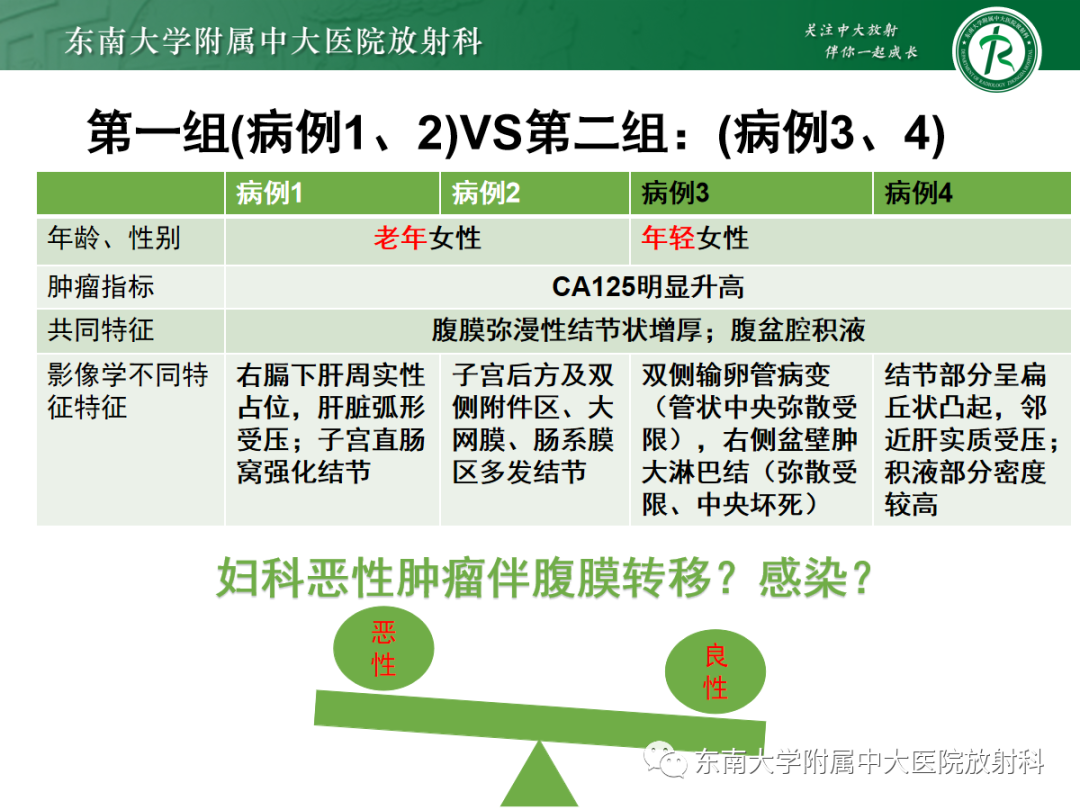 影像PPT - 【PPT】腹膜弥漫性病变-30 影像PPT - 【PPT】腹膜弥漫性病变-30