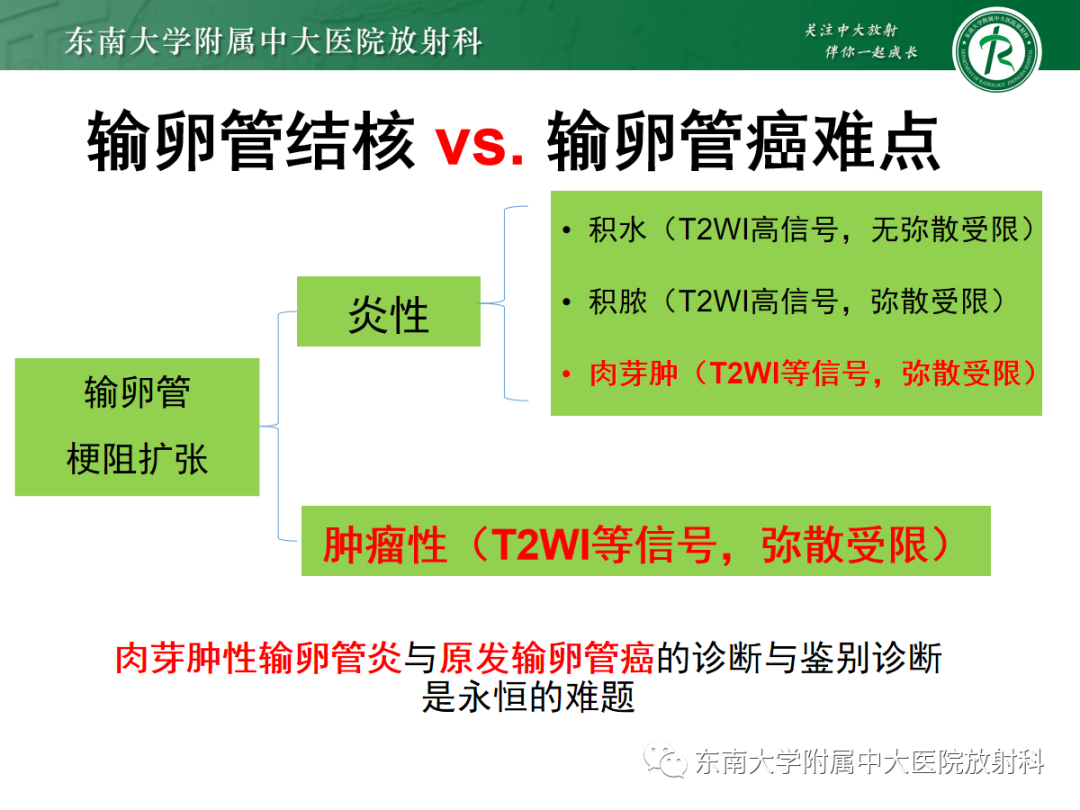 影像PPT - 【PPT】腹膜弥漫性病变-33 影像PPT - 【PPT】腹膜弥漫性病变-33