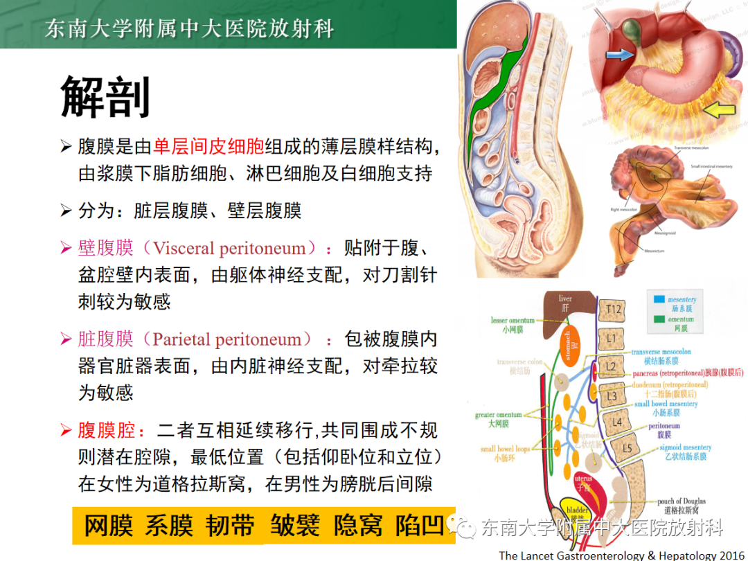 影像PPT - 【PPT】腹膜弥漫性病变-37 影像PPT - 【PPT】腹膜弥漫性病变-37