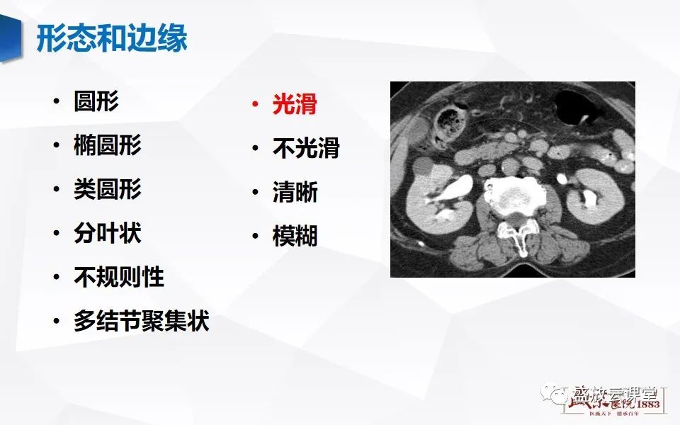 影像PPT - 【PPT】肾脏肿瘤影像诊断思辨-12