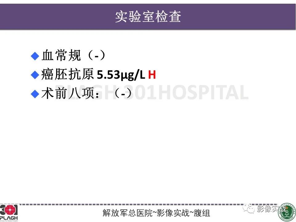 影像PPT - 【病例】化脓性胆囊炎1例CT及MR-3