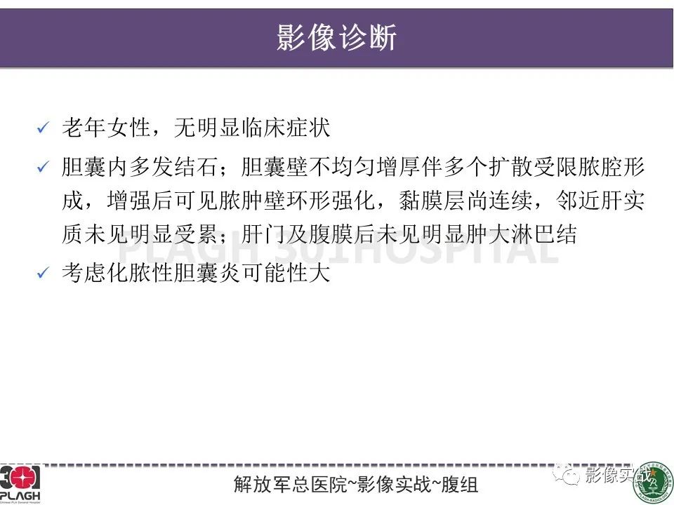 影像PPT - 【病例】化脓性胆囊炎1例CT及MR-19