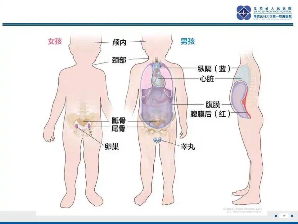 影像PPT - 【PPT】颅内畸胎瘤-17