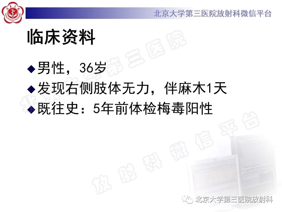 影像PPT - 【PPT】少突胶质细胞瘤-2